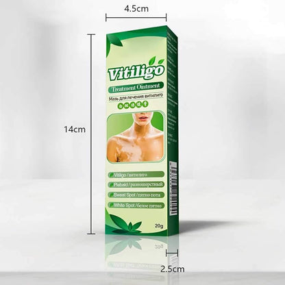 Vitiligo